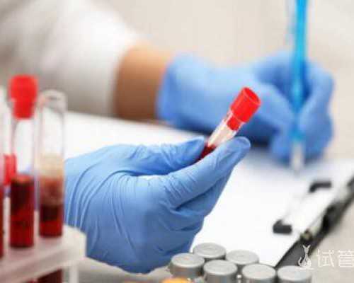 国内供卵代怀代生,无创dna主要检查胎儿哪些方面,无创DNA检测的作用介绍