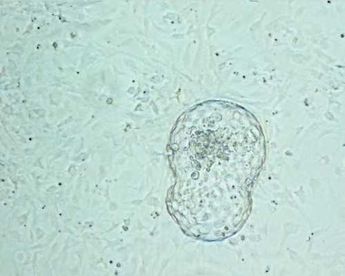 中国目前供卵试管婴儿成功率,哪些遗传疾病需要做第三代试管婴儿筛选？