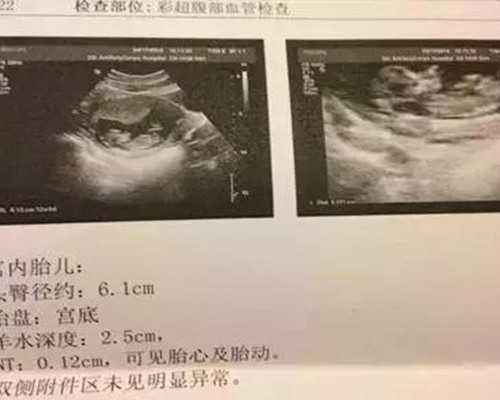 国内供卵官网,人流后*内膜厚度会发*什么样的变化