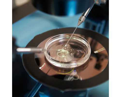 国内供卵费用明细查询,试管婴儿技术是否能助孕?三代试管婴儿孩子的费用是多少?